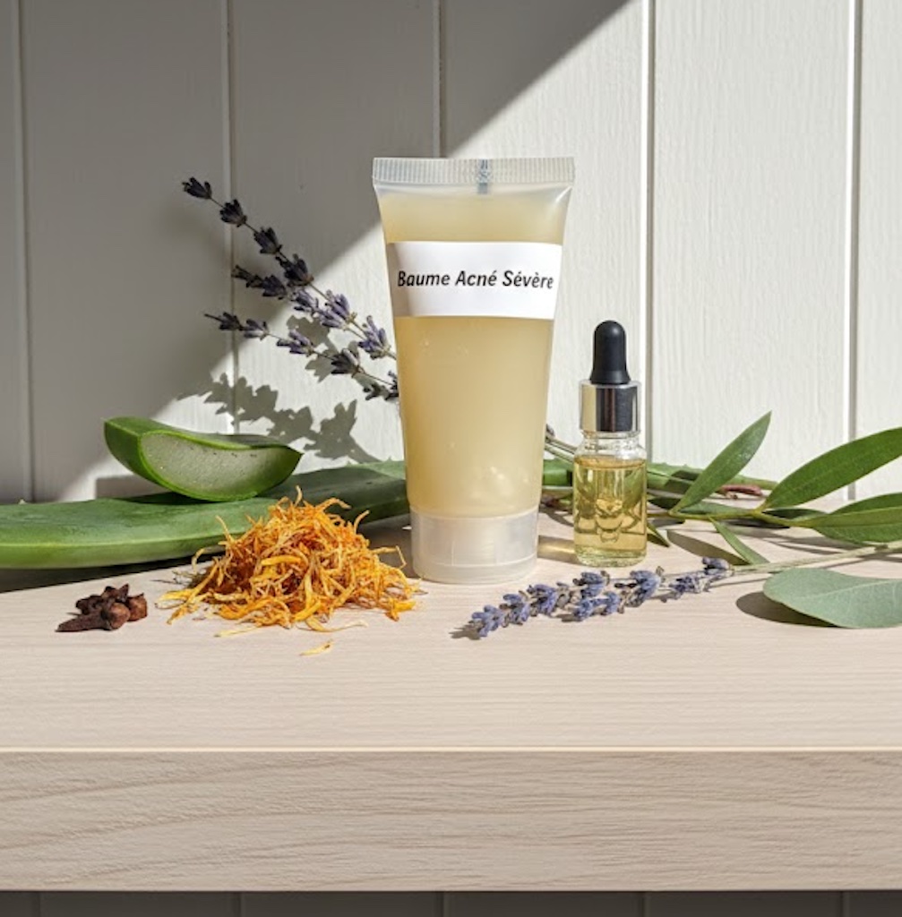 baume-acné-sévère-naturel